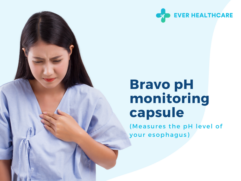 Bravo pH monitoring capsule [24 and 48 hours] in Thailand 2023 Compare